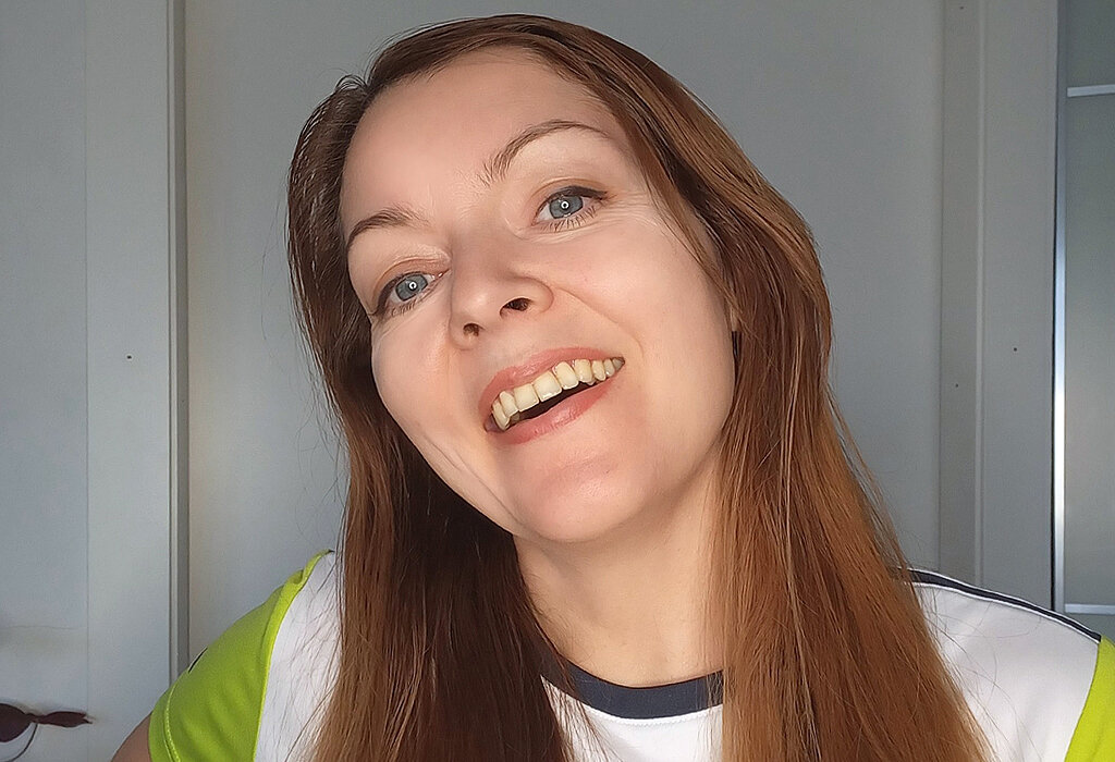 Через 3 года после снятия брекетов