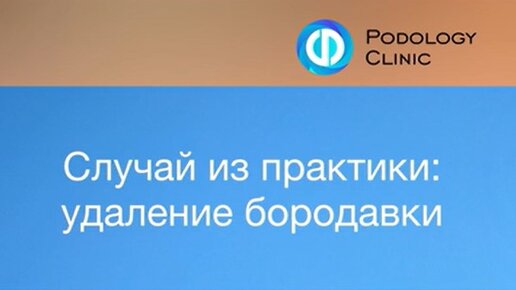 КЛИНИКА ПОДОЛОГИИ ПОЛЁТ | Удаление бородавки на мизинце / бородавка на ...