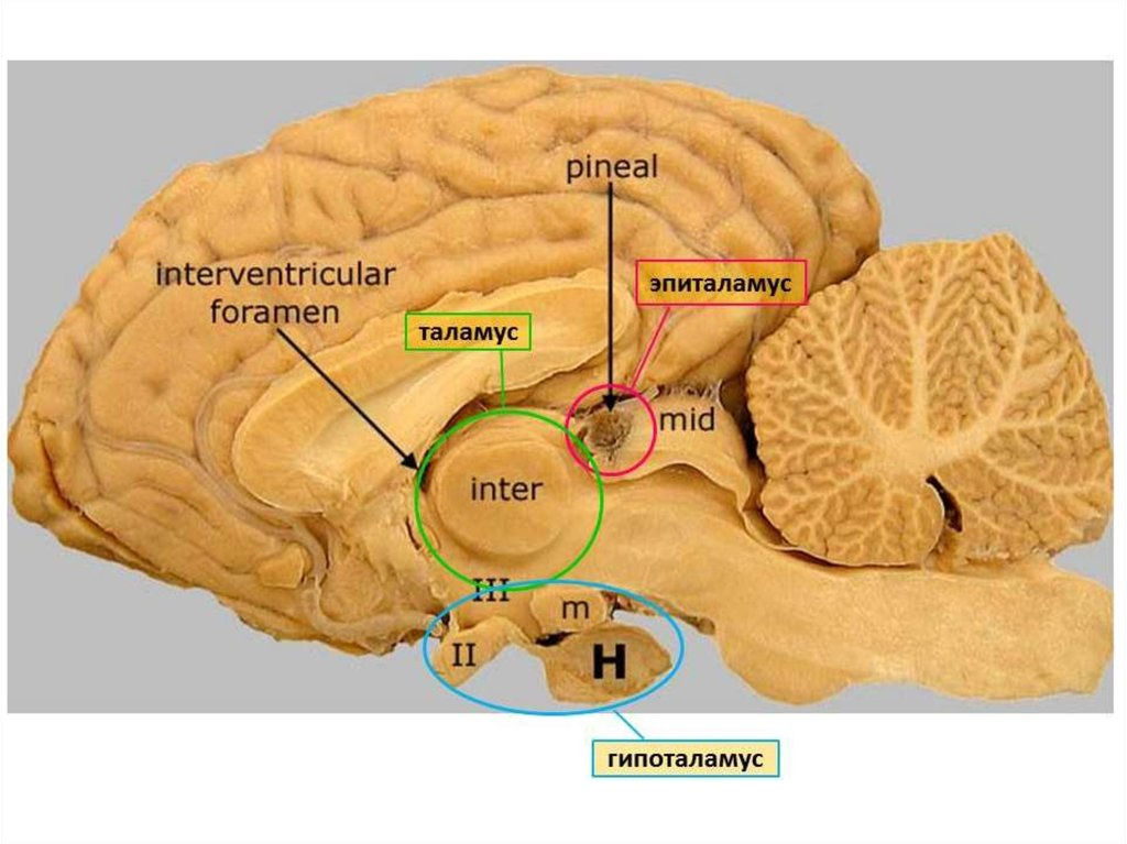 Спайка поводков. Анатомия головного мозга таламус. Зрительный бугор таламус анатомия. Промежуточный мозг таламус гипоталамус эпиталамус. Мозолистое тело свод передняя спайка.