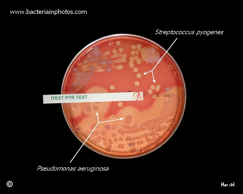 рецепт для мочевых путей 2021. стафилококк в мочевом. бактерия золотистый стафилококк. пиогенный стрептококк. ауреус бактерия.