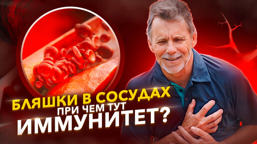 Download Video: Как очистить сосуды от бляшек