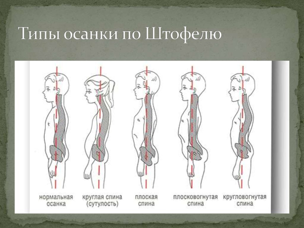 Двигательные паттерны