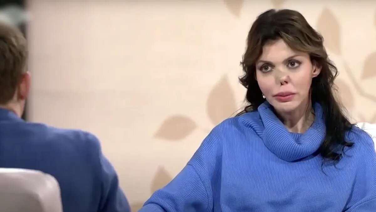«С Алисой уже всё нормально» Мать Алисы Аршавиной, лишившейся носа из ...