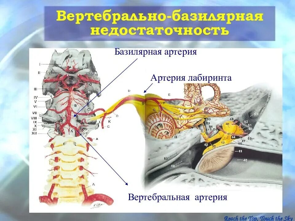 Вертебрально базилярная недостаточность. Вертебробазилярная артерия. Вертобробазилярная артерия. Вертебро-базиллярные сосуды.