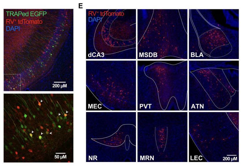     Окрашенные нейроны на срезах мозга мышей. Nguyen et. al / Science Advances, 2023
