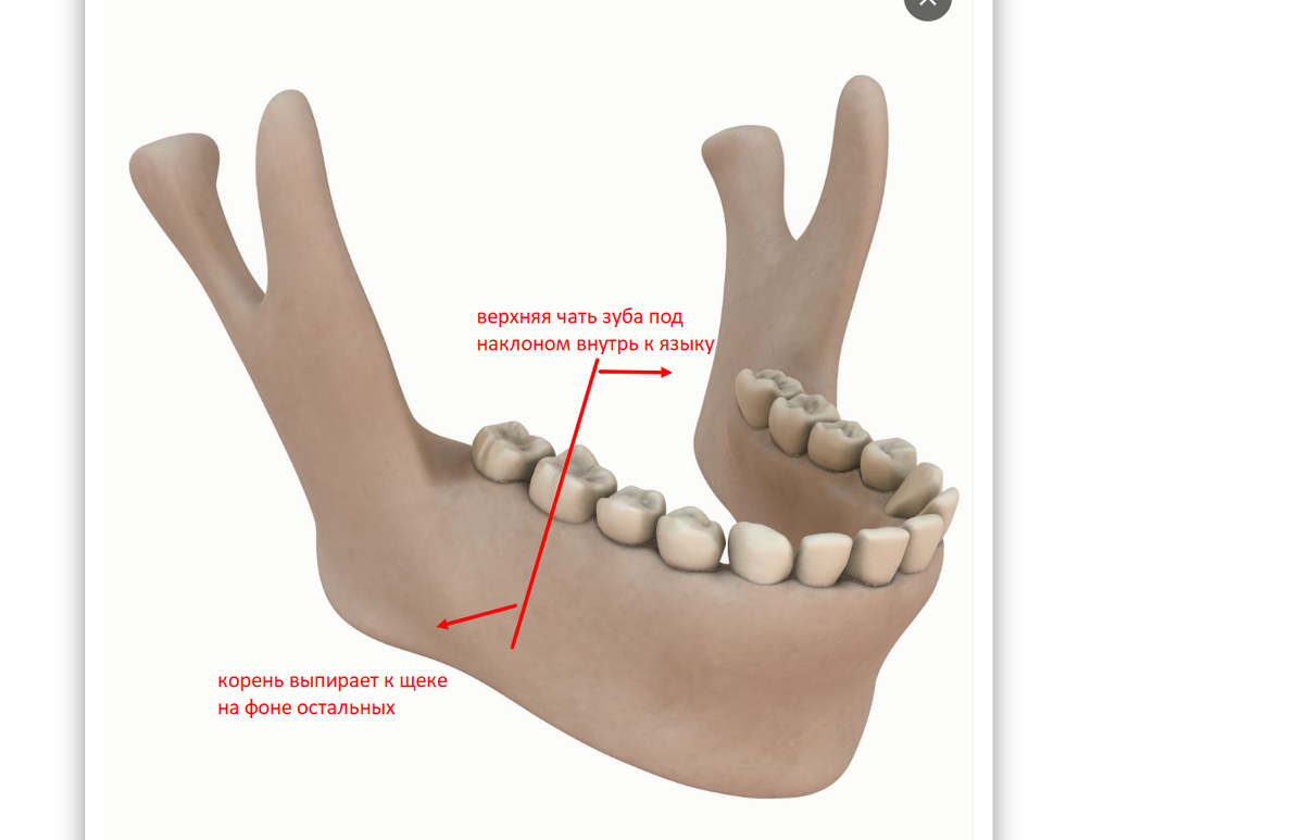 попыталась описать как стоит зуб