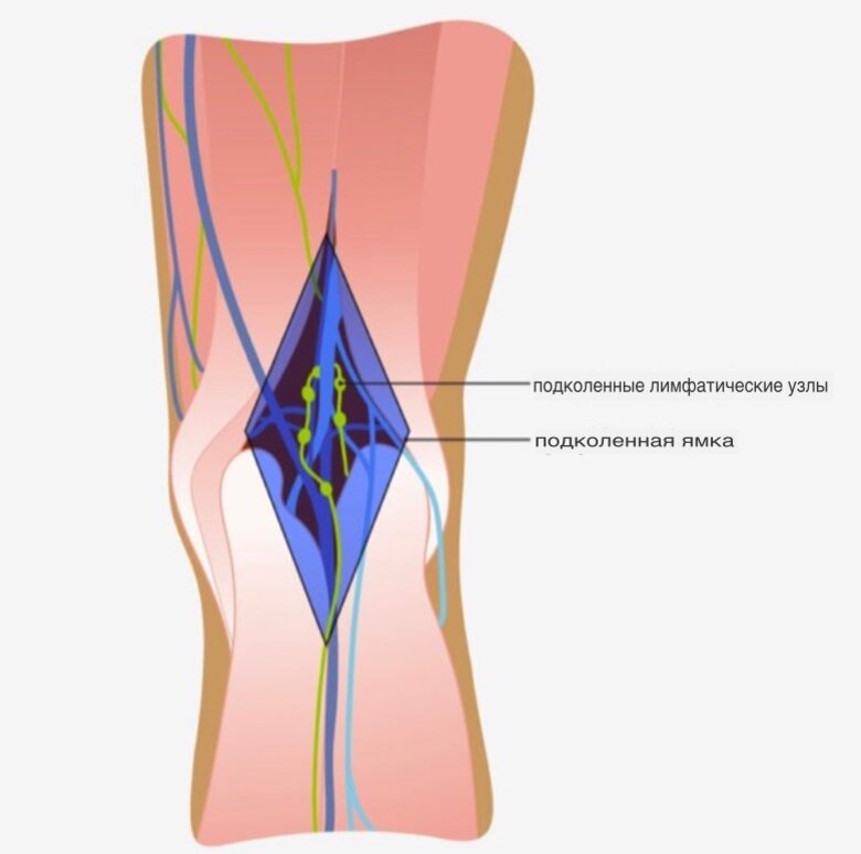 Лимфоузлы под коленом сзади: симптомы и причины воспаления