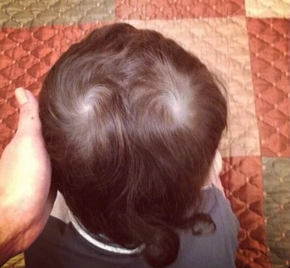 Двойная макушка.