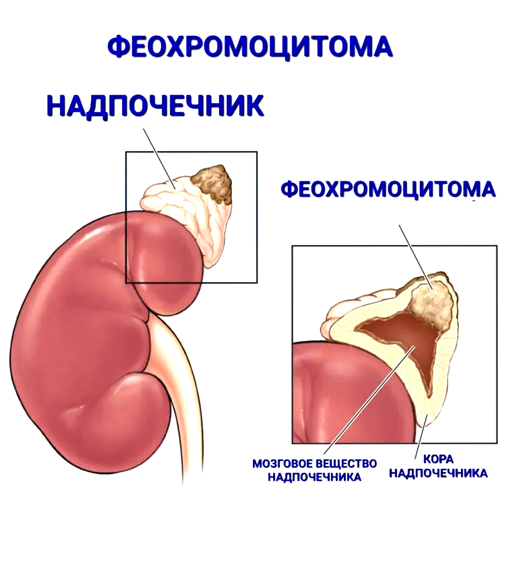 Одна ночь с лабильной гипертонией: Помощь с неожиданностями и скачками  давления. | Даниил Богданов. Кумиром должен быть ты! | Дзен