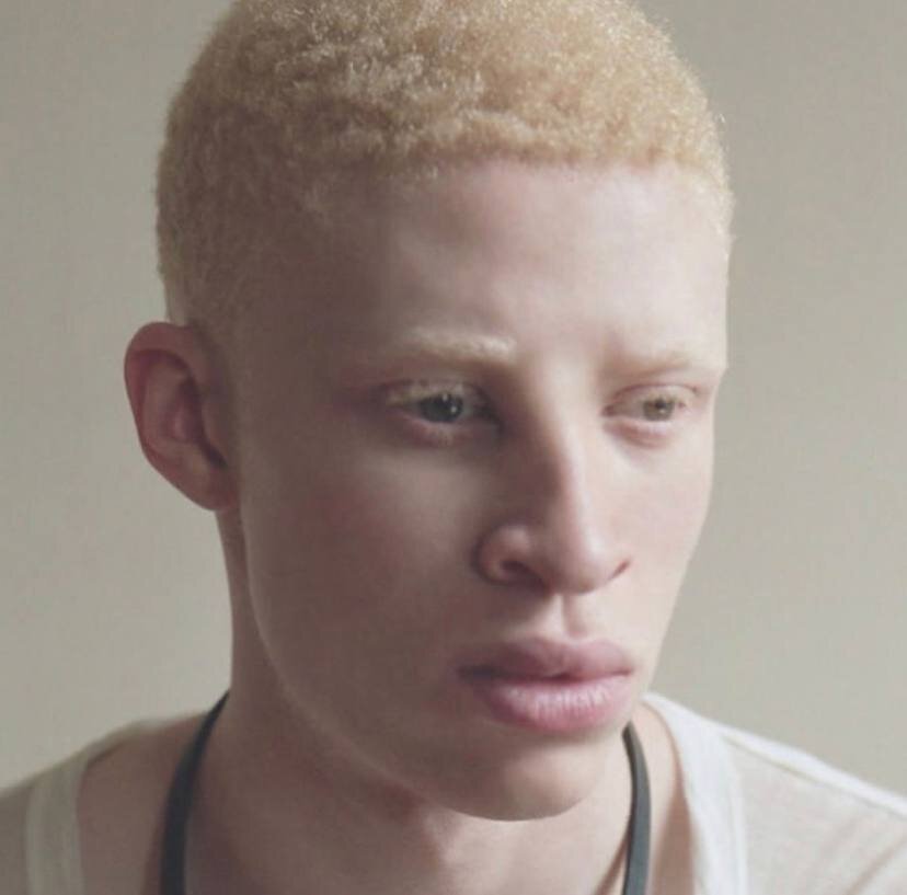 Белый негр. Шон Росс модель. Шон Росс альбинос. Модель альбинос Шон Росс. Альбинос негроидной расы.