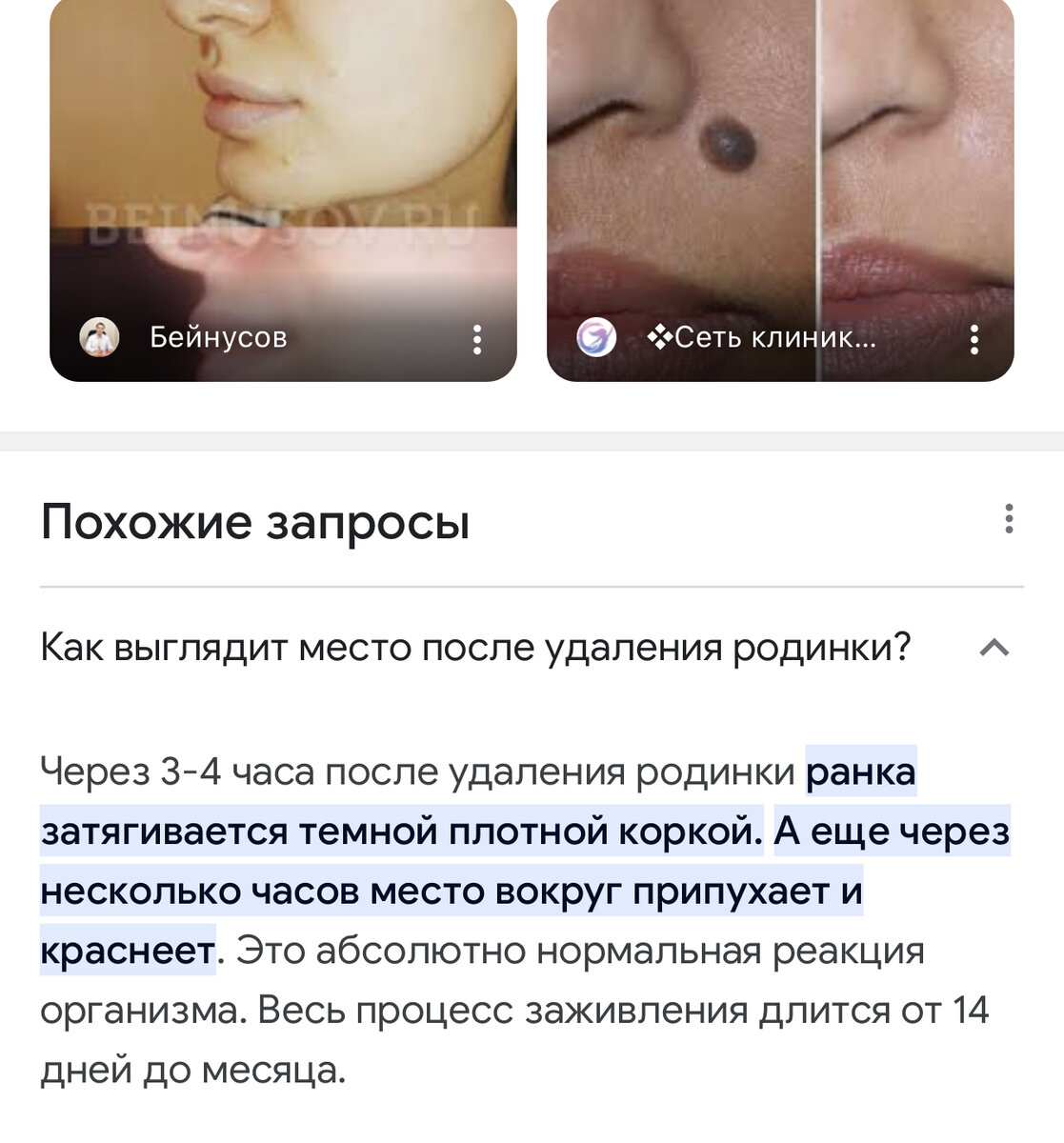 Хирургическое удаление родинок Киев Цена МЦ SENSAVI