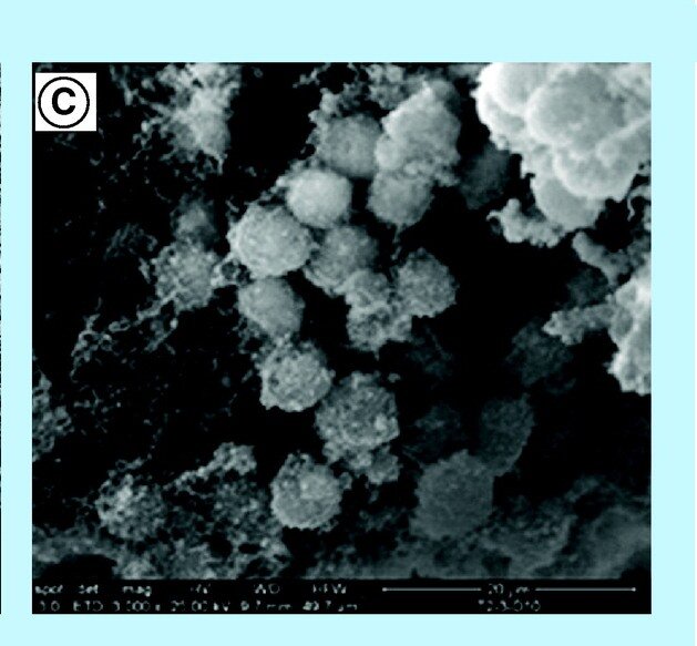 Микрофотография биопленки Золотистого стафилококка на катетере. Источник: https://www.future-science.com