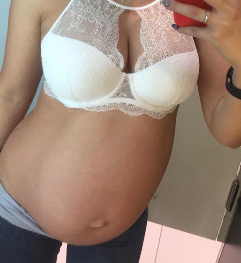 Фото пациентки пластического хирурга Лигатюка Д.Д.