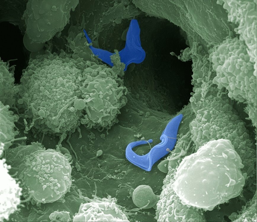 Электронная микроскопия трипаносомы