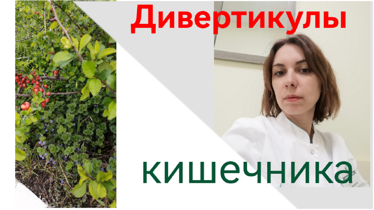 Дивертикулы кишечника фото