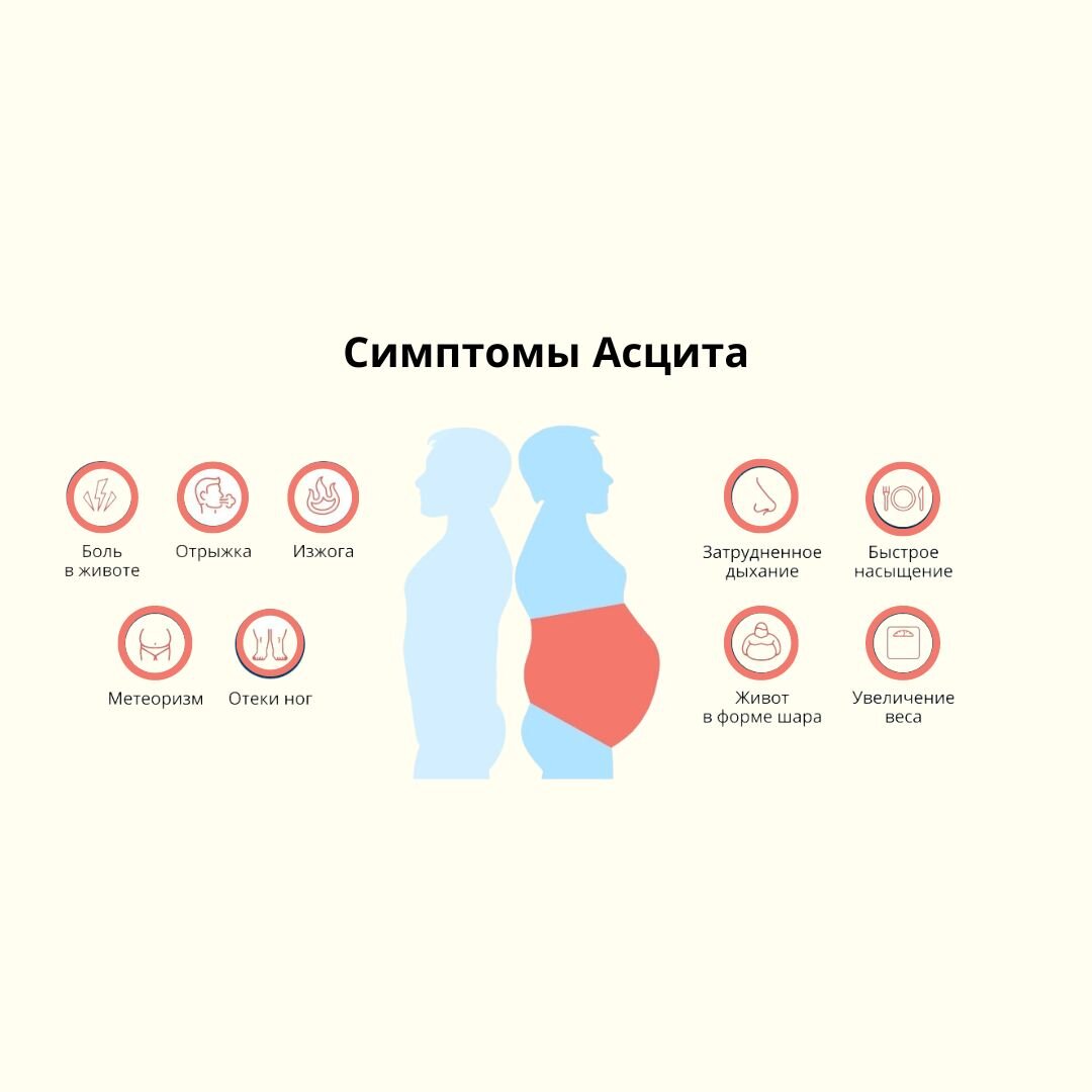 Асцит при гепатите | Моя Печень | Дзен