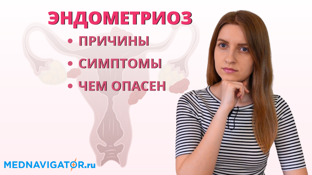 Чем опасен ЭНДОМЕТРИОЗ матки, яичников и брюшины? Причины, симптомы и  осложнения | Mednavigator.ru | Дзен