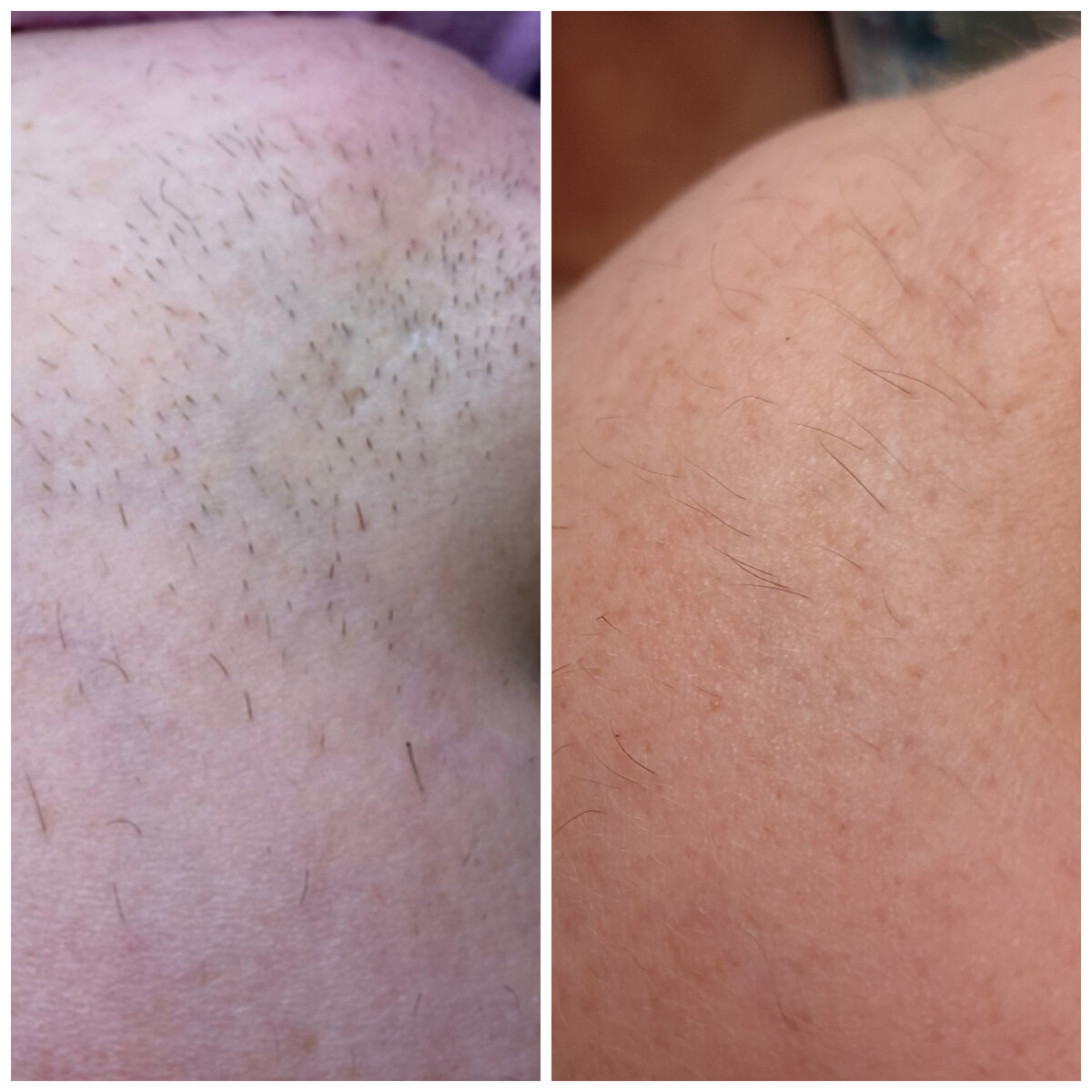 До и в процессе курса