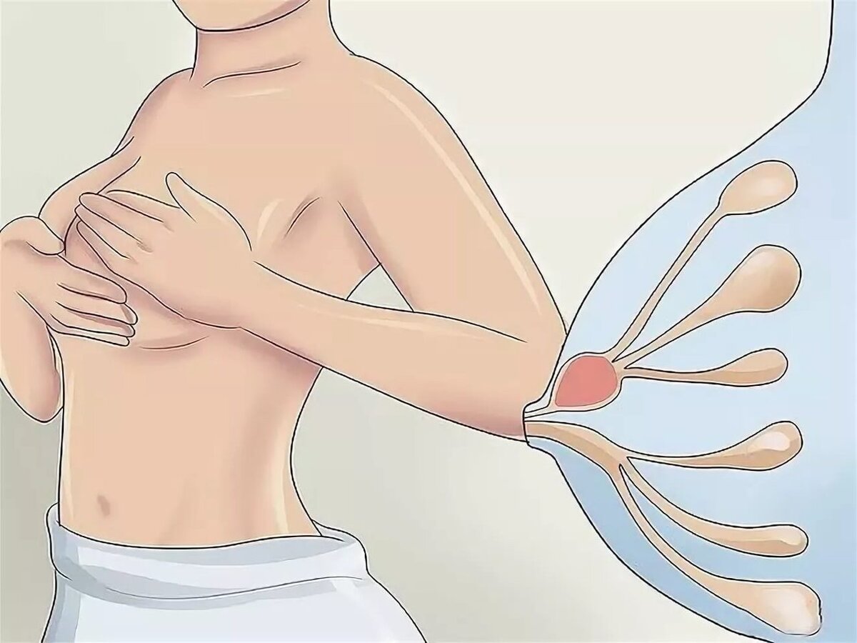 Способы расцеживания молочной железы