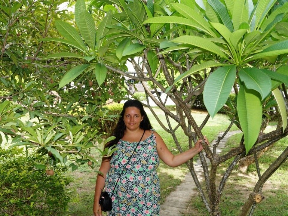 На этом фото видно синяки на руке. Самуи 2016 год