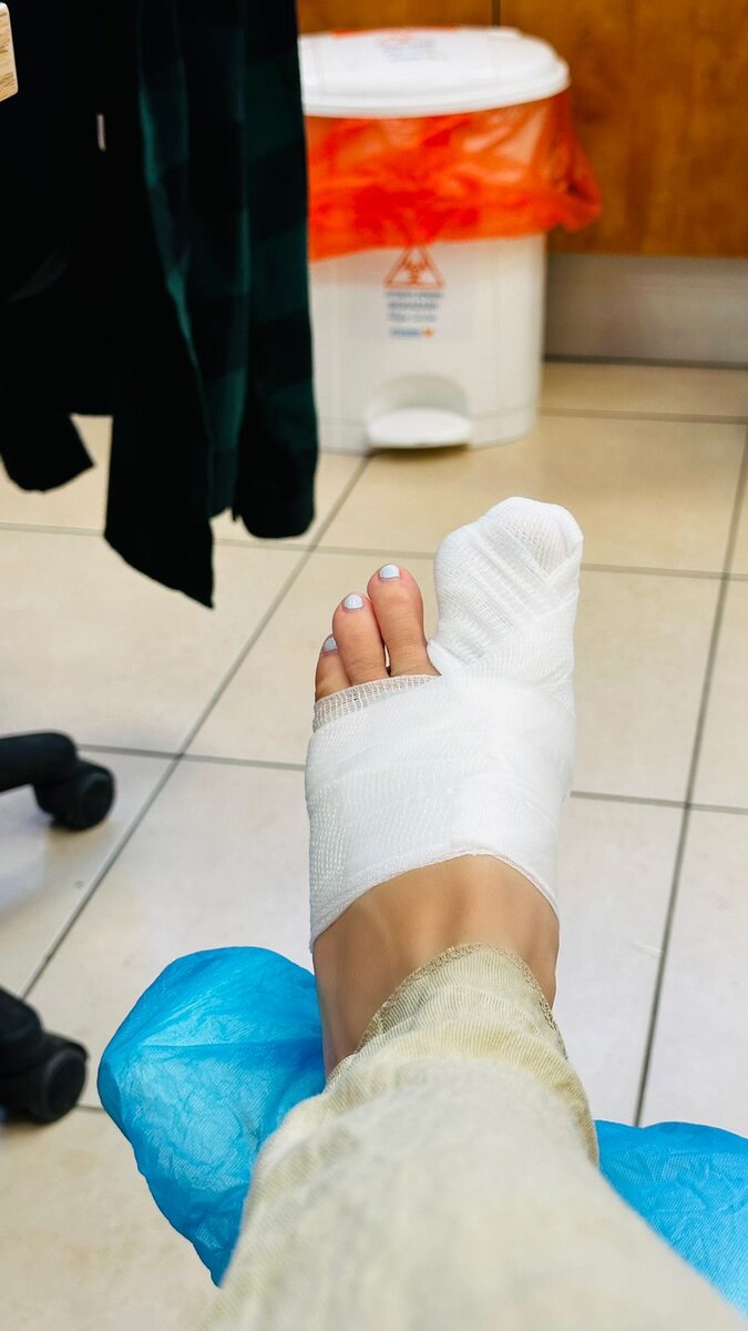 Перелом. Дочка постаралась)