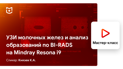 УЗИ молочных желез и анализ образований по BI-RADS на Mindray Resona i9