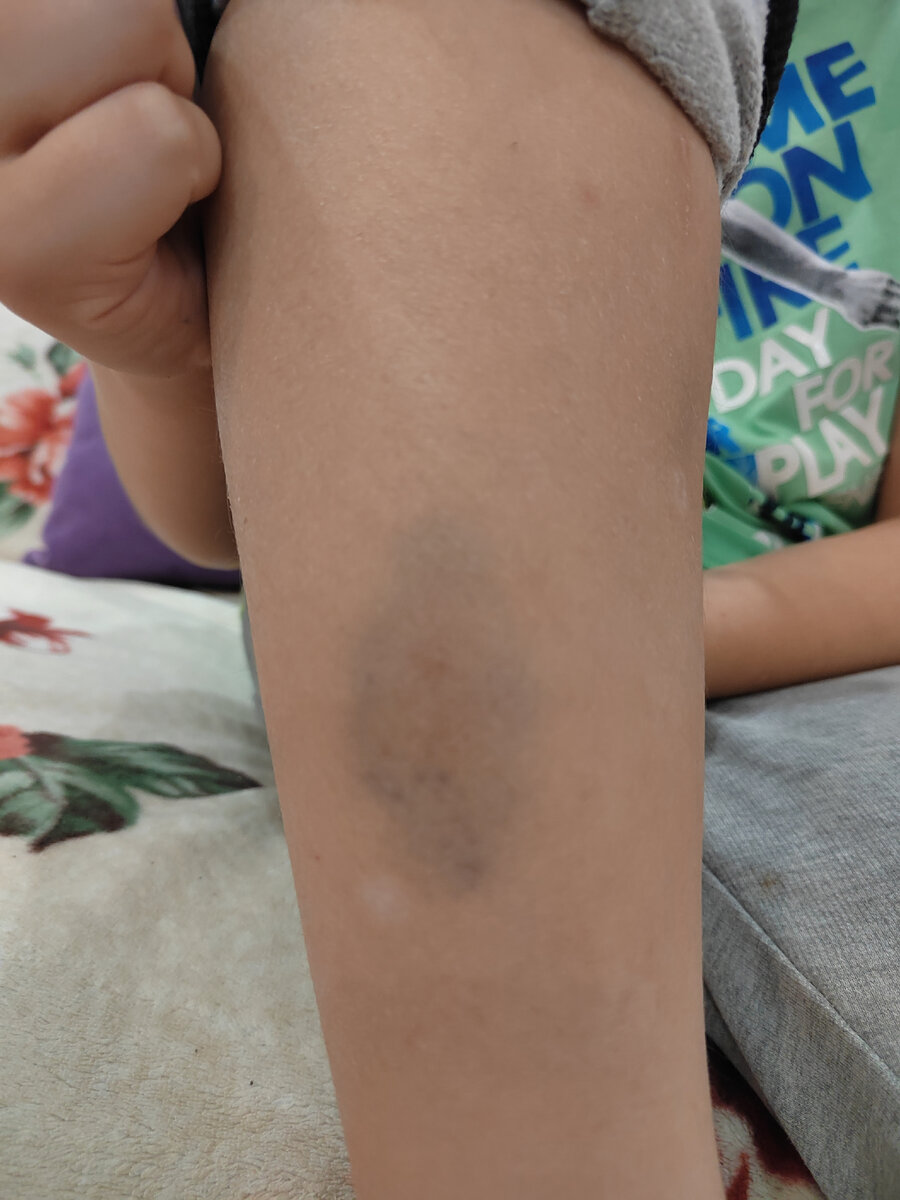 "Красивая" нога