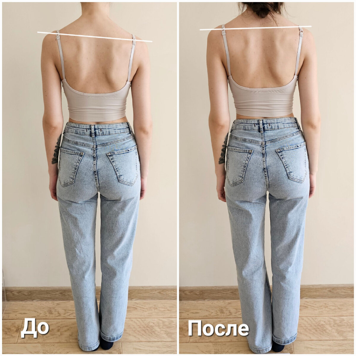 Пациент занимается активно спортом. Сделала курс массажей 15 сеансов, на осанку ни как повлияло. 