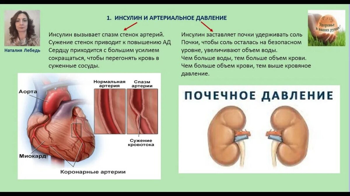 Исулинорезистентность, диабет и проблемы с почками. Отеки, камни, ХПН.  Часть 1 | Путь к себе | Дзен