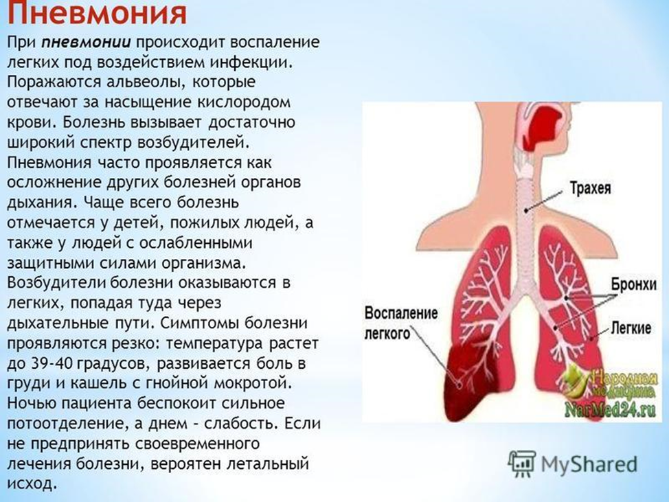 Сильный кашель после