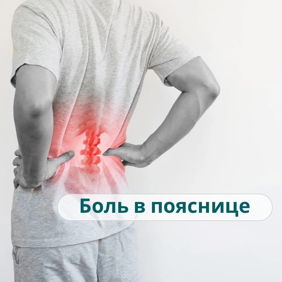 Боли в спине карта