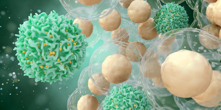 Почему в других странах раковую опухоль уничтожают, а в Израиле для успешного лечения, прилагают все усилия, чтобы ее сохранить и вырастить