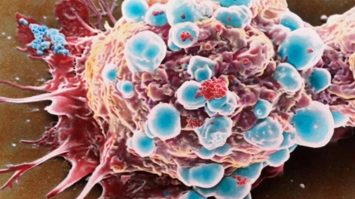 13 симптомов, которые нельзя игнорировать, если вы они у вас появились. Фото: thesun.co.uk