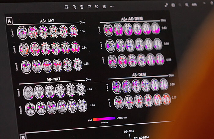    Denis Balibouse/Reuters