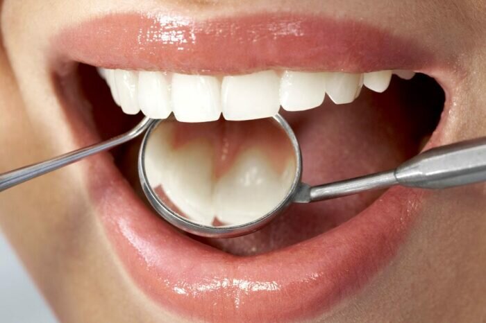 Если воспалилась десна, нужно к стоматологу. / Фото: family-dent24.ru