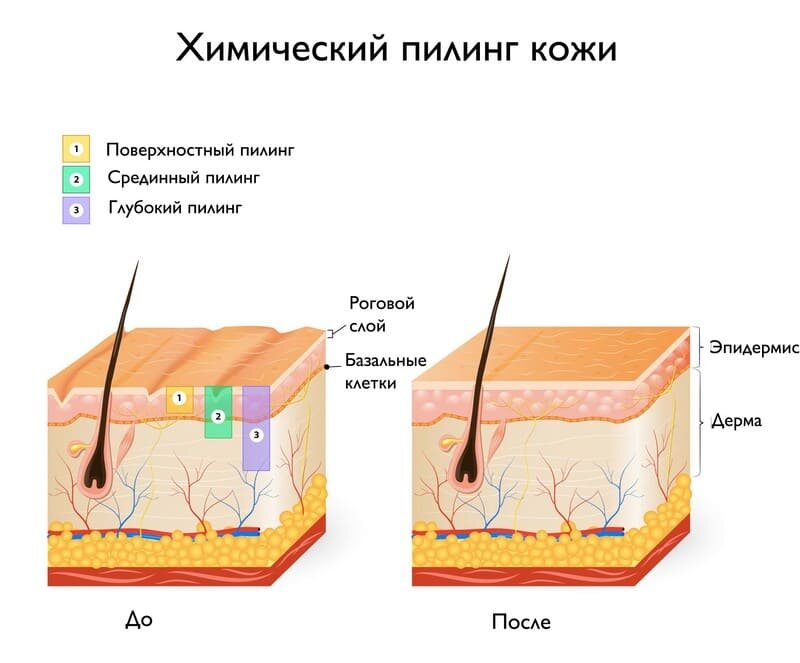 Лечение аноргазмии в Казани – аугментация точки G и клитора, клиника «Качество Жизни»