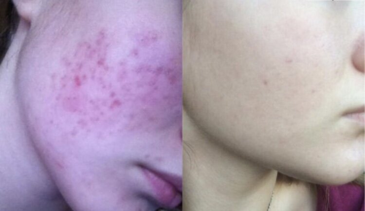 Использование средств из статьи