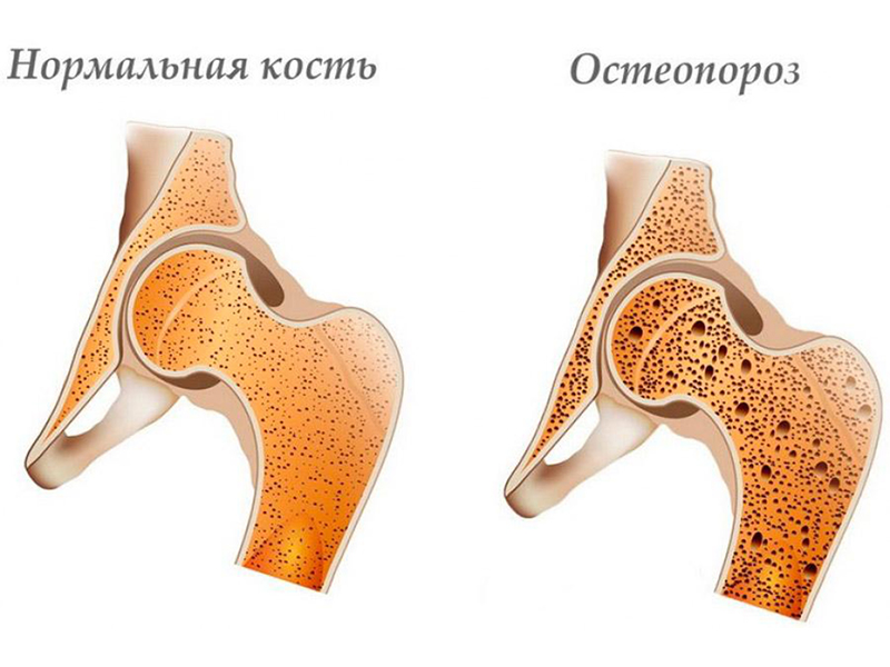 Результаты кости