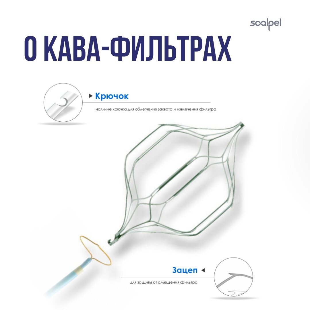 Установка кава фильтра. Кава-фильтр OPTEASE retr Filter 90 Jug/Ant. OPTEASE кава фильтр. OPTEASE retrievable Vena Cava Filters кава фильтр. Фильтр для улавливания тромбов.