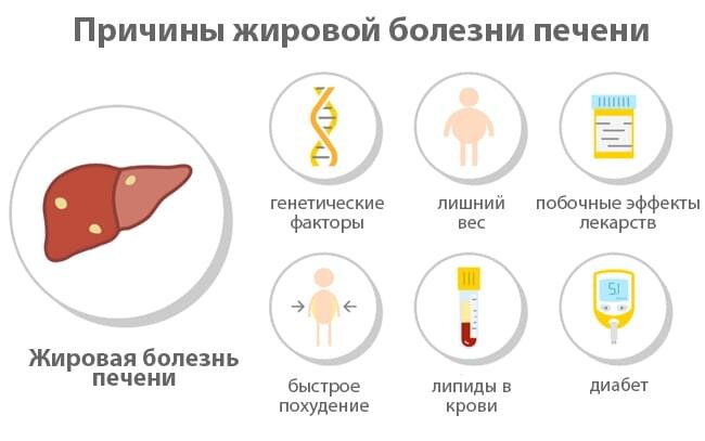 Презентация жировая болезнь печени