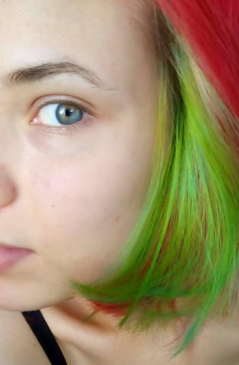 Как действует зеленка на волосы