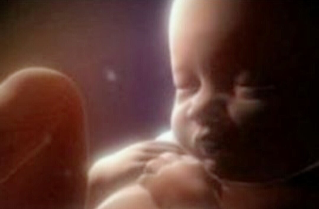 Фото из интернета.