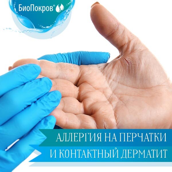 Аллергия на перчатки и контактный дерматит: причины, лечение