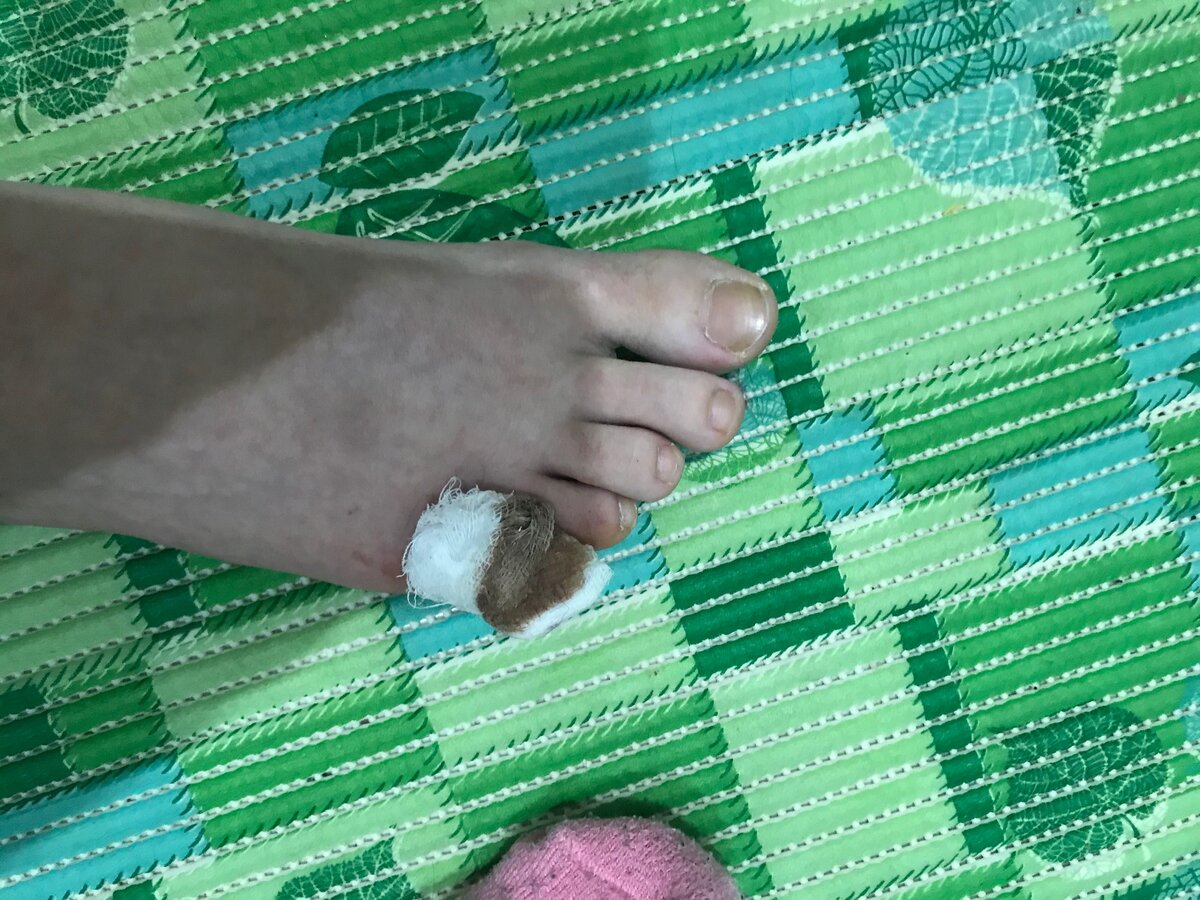 После операции