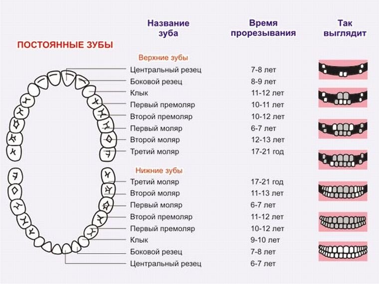 Синдром прорезывания зубов