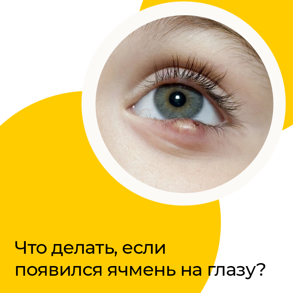 «Народный метод «плюнуть в глаз» забудьте навсегда»: как лечить ячмень у ребенка