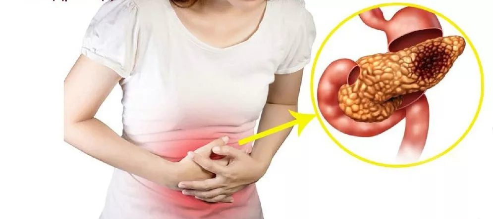 Врач рассказала, как болит поджелудочная железа: 9 признаков острого и ...