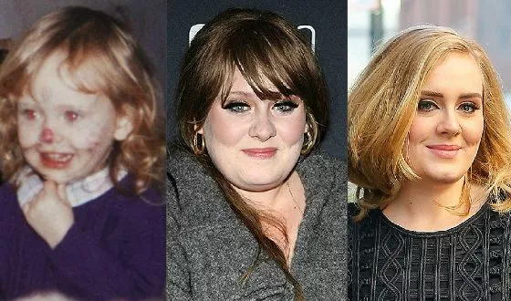 Адель в детстве, молодости и в настоящее время.
