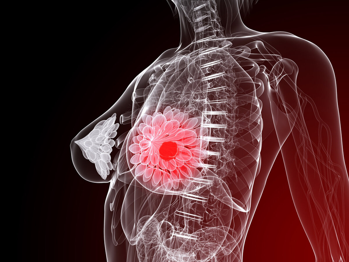 Изображение взято с сайта oncology-central.com