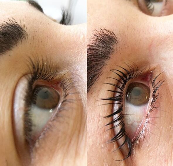 Процедура &laquo;ботокс ресниц&raquo; имеет все большую популярность среди женщин, желающих приобрести идеальный взгляд. Уже несколько лет ботокс стал эффективным способом улучшить состояние ресниц и придать им дополнительную объемность и пышность.